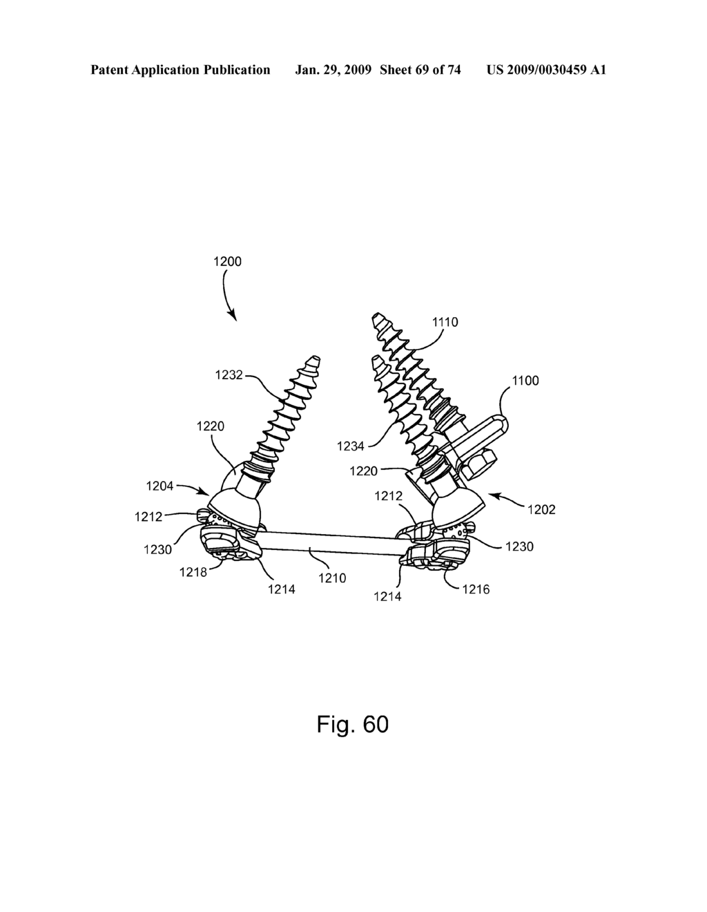 SPINAL FACET IMPLANT WITH SPHERICAL IMPLANT APPOSITION SURFACE AND BONE BED AND METHODS OF USE - diagram, schematic, and image 70