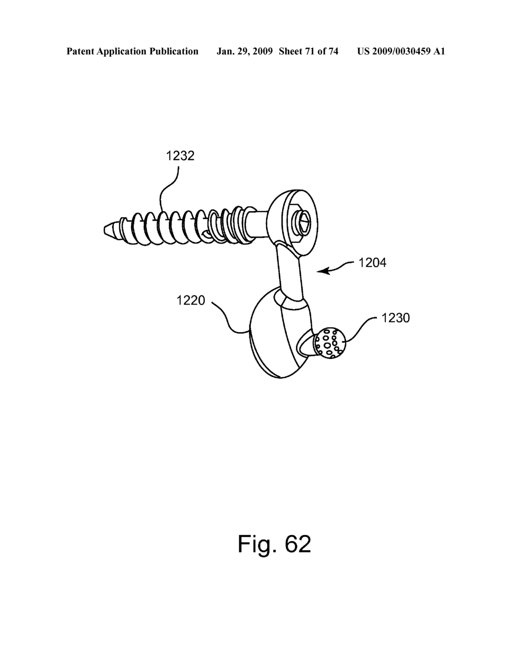 SPINAL FACET IMPLANT WITH SPHERICAL IMPLANT APPOSITION SURFACE AND BONE BED AND METHODS OF USE - diagram, schematic, and image 72