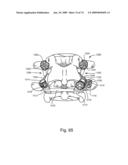 SPINAL FACET IMPLANT WITH SPHERICAL IMPLANT APPOSITION SURFACE AND BONE BED AND METHODS OF USE diagram and image