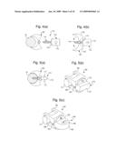 Segmental Orthopaedic device for spinal elongation and for treatment of Scoliosis diagram and image