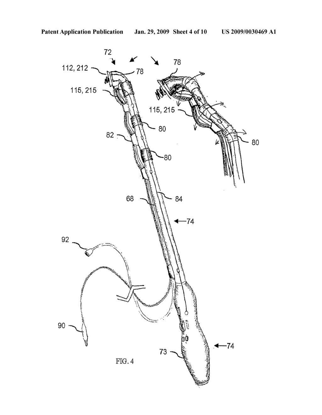 Cardiac Resynchronization Therapy Systems and Methods - diagram, schematic, and image 05