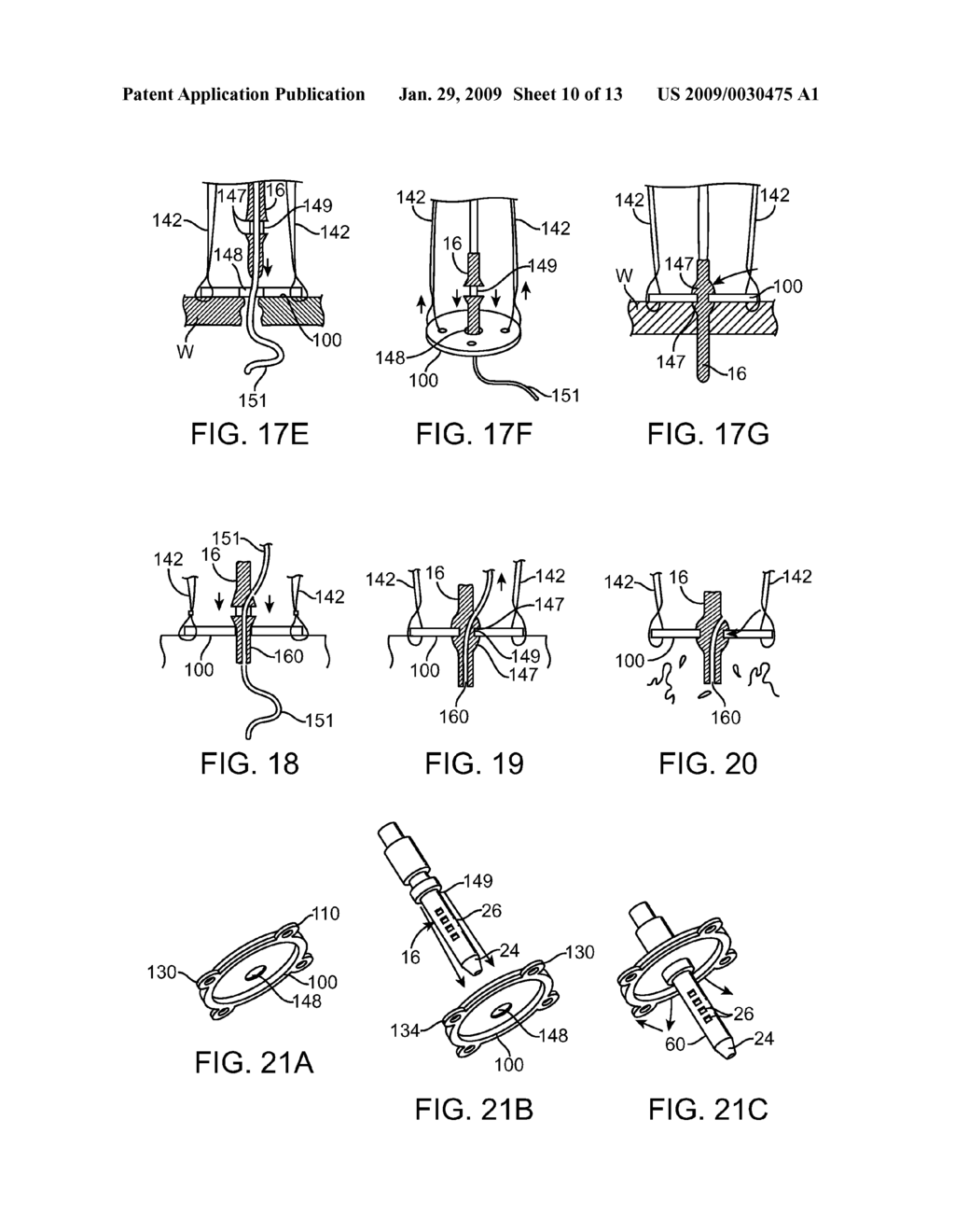 Gastric Stimulation Systems and Methods Utilizing a Transgastric Probe - diagram, schematic, and image 11