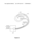 METHOD, DEVICE AND COMPUTER PROGRAM FOR GENERATING A CONTROL SIGNAL FOR A COCHLEAR IMPLANT, BASED ON AN AUDIO SIGNAL diagram and image