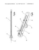 INSERTION SYSTEM FOR STENTS, COMPRISING TENSION-COMPRESSION KINEMATICS diagram and image