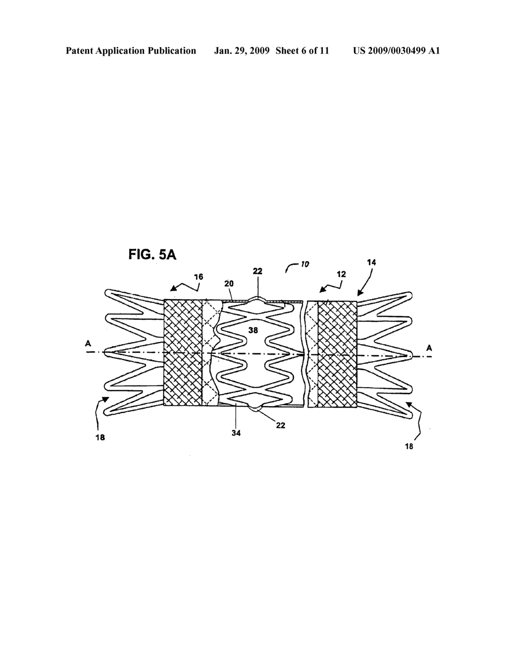 FLEXIBLE STRETCH STENT-GRAFT - diagram, schematic, and image 07