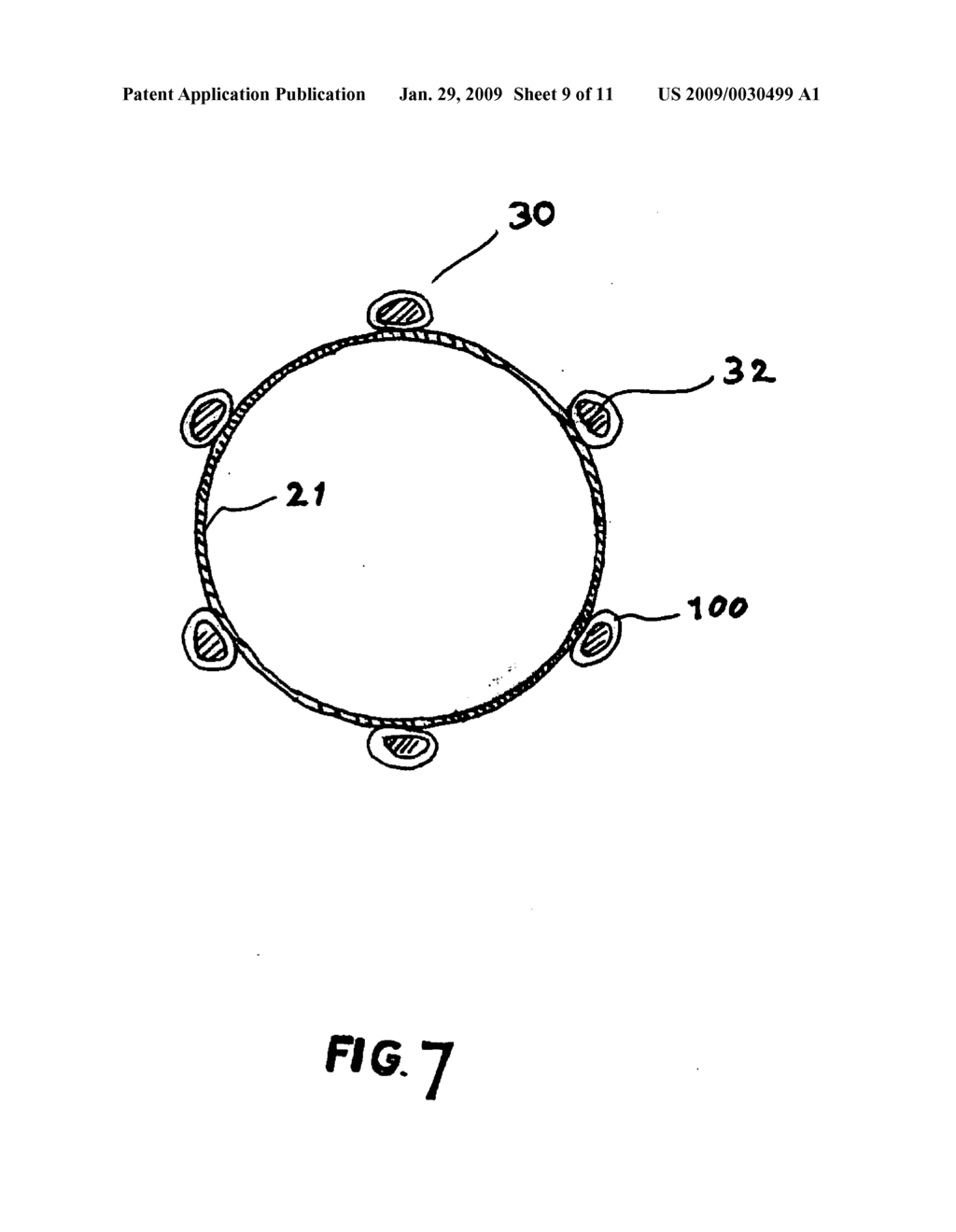 FLEXIBLE STRETCH STENT-GRAFT - diagram, schematic, and image 10