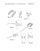 INTERVERTEBRAL CAGE DESIGNS diagram and image