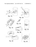 INTERVERTEBRAL CAGE DESIGNS diagram and image