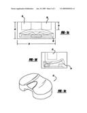 ANTIOXIDANT DOPING OF CROSSLINKED POLYMERS TO FORM NON-ELUTING BEARING COMPONENTS diagram and image