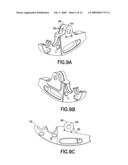 Jaw assembly diagram and image