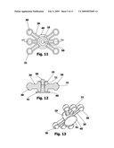 Limb Dampeners diagram and image