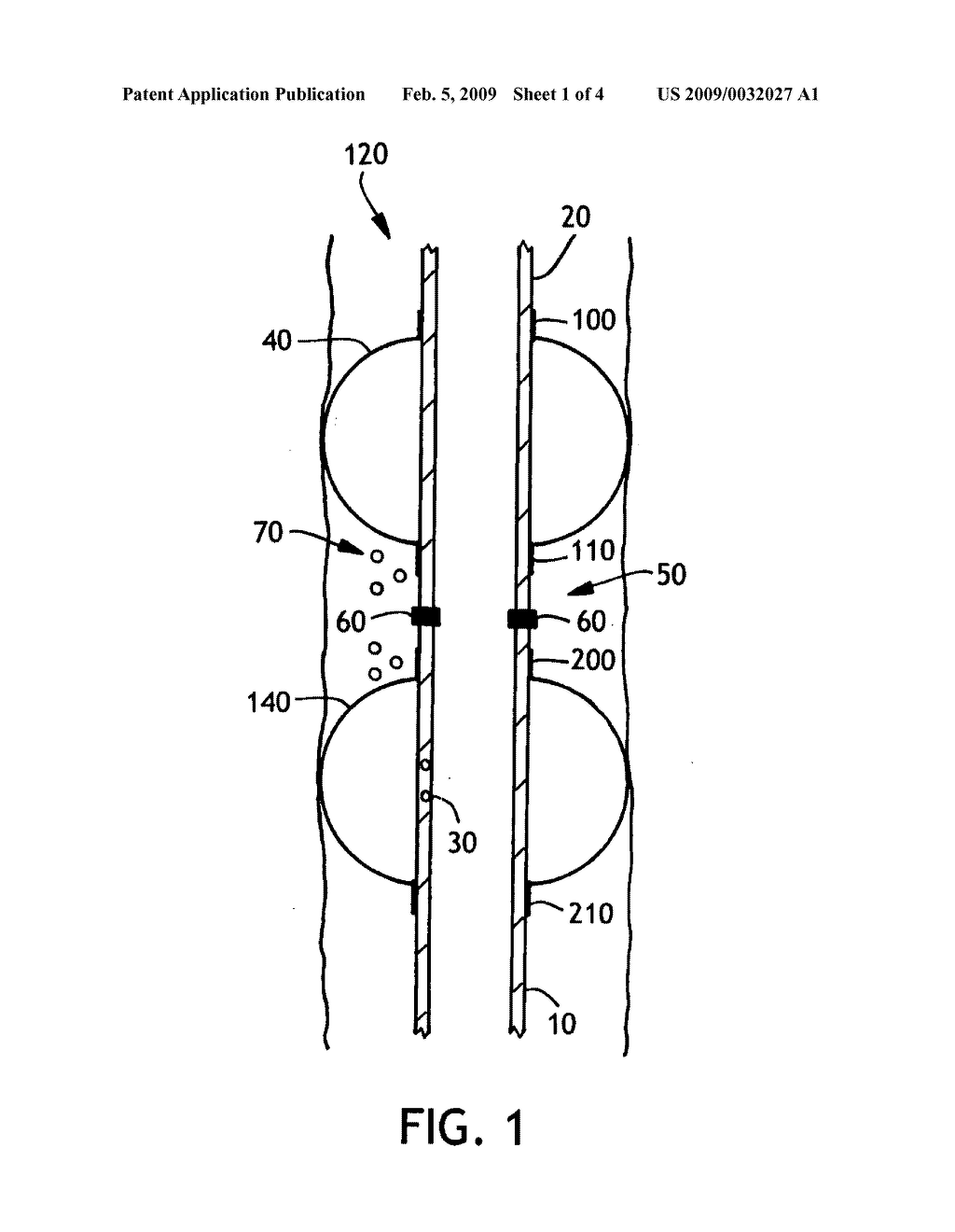 Multiple balloon endotracheal tube cuff - diagram, schematic, and image 02