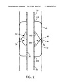 Multiple balloon endotracheal tube cuff diagram and image