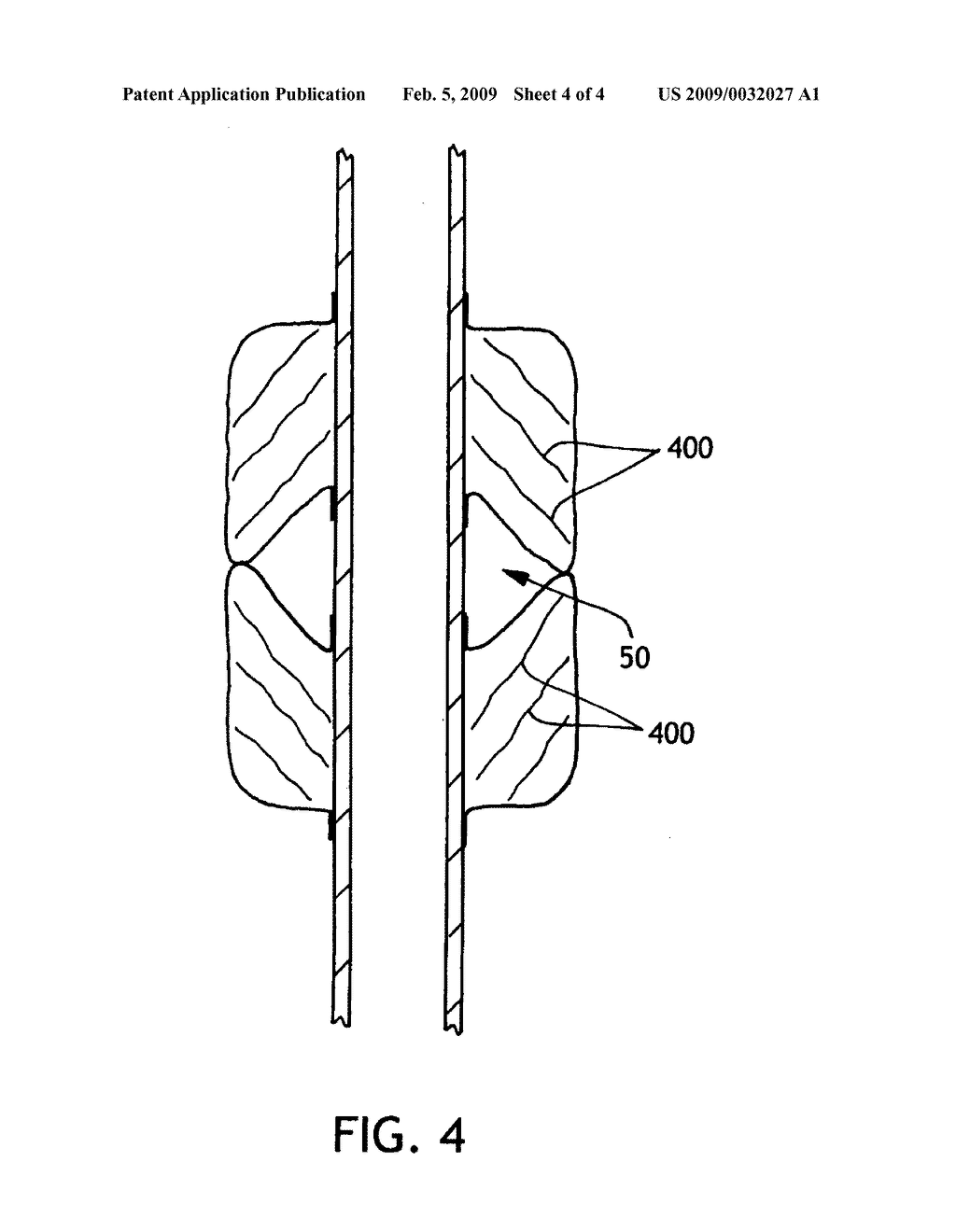 Multiple balloon endotracheal tube cuff - diagram, schematic, and image 05