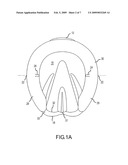 Horseshoe And Balancing Method diagram and image