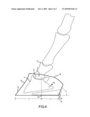 Horseshoe And Balancing Method diagram and image