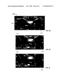 Method for customs inspection of baggage and cargo diagram and image