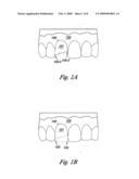 Mapping abnormal dental references diagram and image