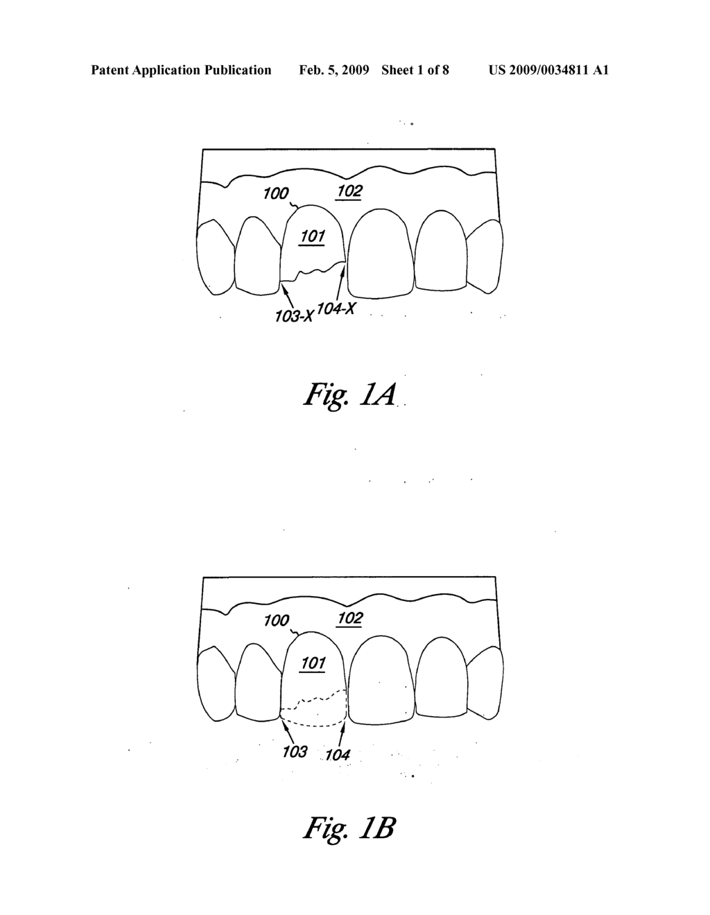 Mapping abnormal dental references - diagram, schematic, and image 02