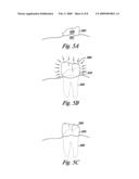 Mapping abnormal dental references diagram and image