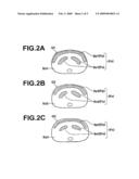 METHOD OF ACQUIRING A DIAGNOSTIC INDEX diagram and image