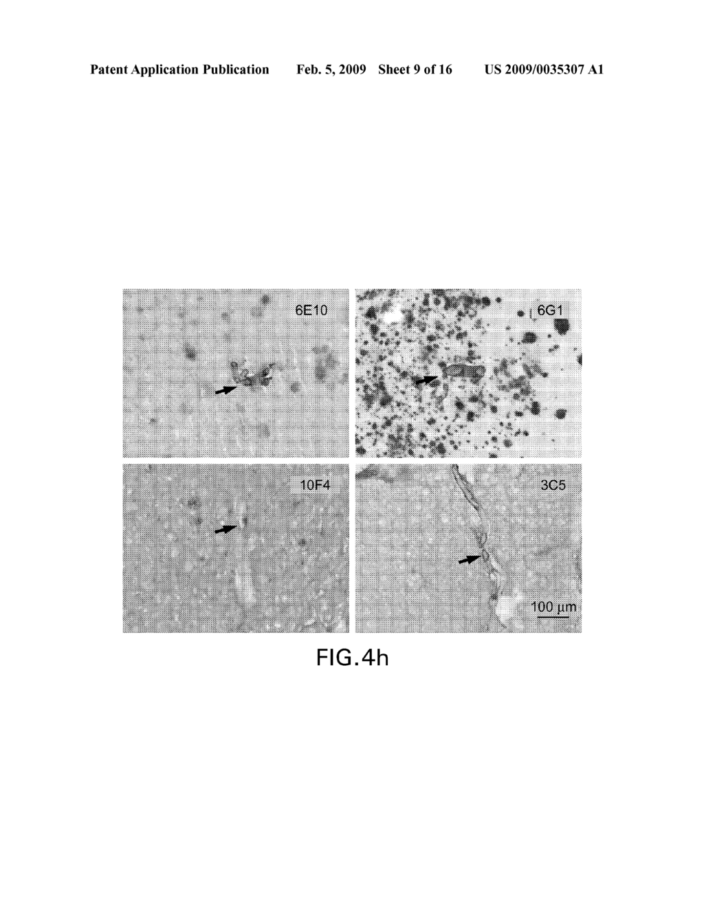 Abeta CONFORMER SELECTIVE ANTI-Abeta GLOBULOMER MONOCLONAL ANTIBODIES - diagram, schematic, and image 10