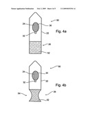 Device and Method for Treating the Anal Sphincter diagram and image