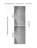 Compositions including androgen receptor degradation (ARD) enhancers and methods of prophylactic or therapeutic treatment of skin disorders and hair loss diagram and image