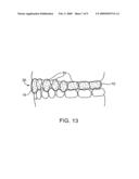 Methods and systems for concurrent tooth repositioning and substance delivery diagram and image