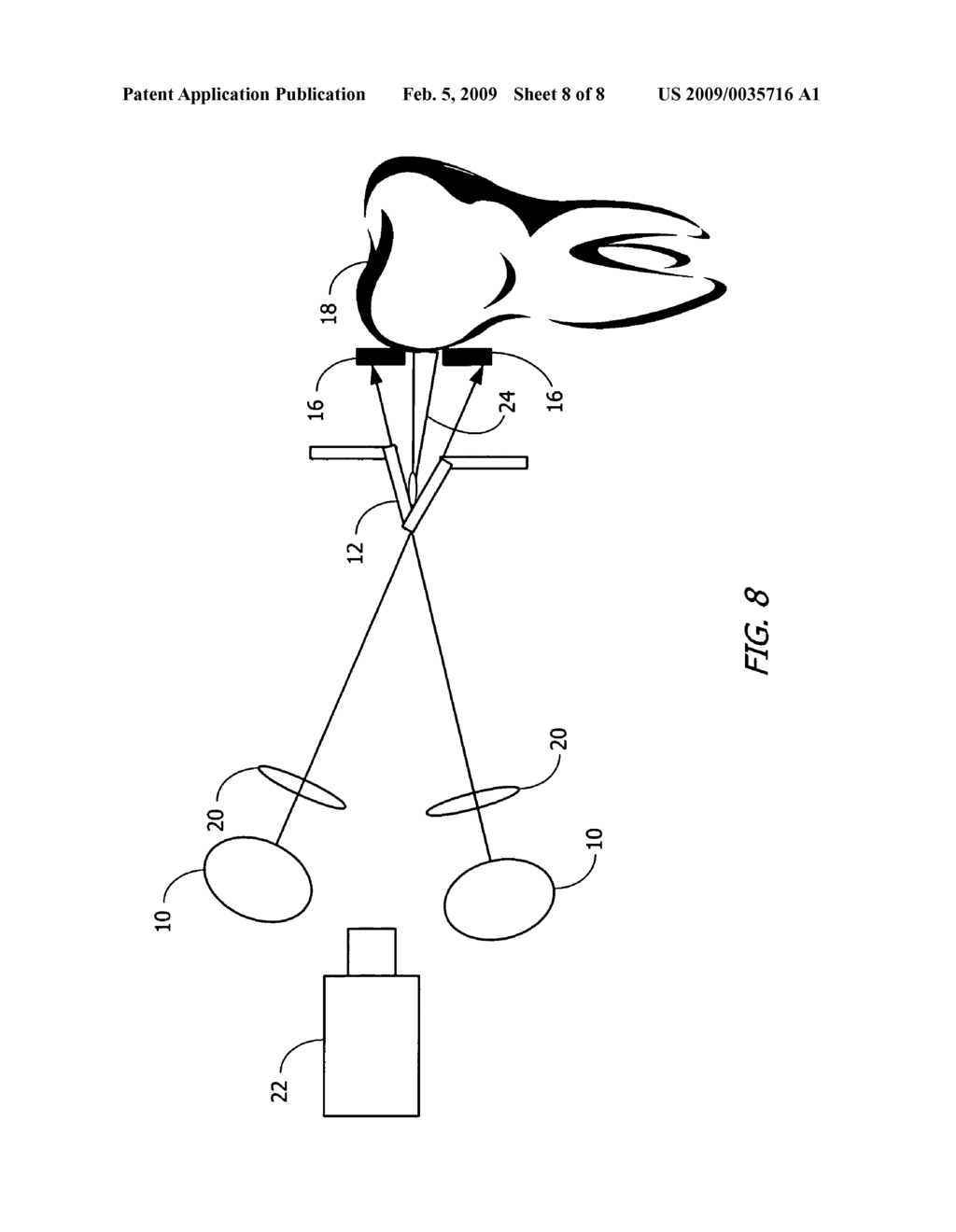 METHODS AND APPARATUS TO POSITION AND ALIGN TEETH USING AN EXO-SHELL - diagram, schematic, and image 09