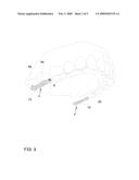 Apparatus for Chewing Obstruction diagram and image