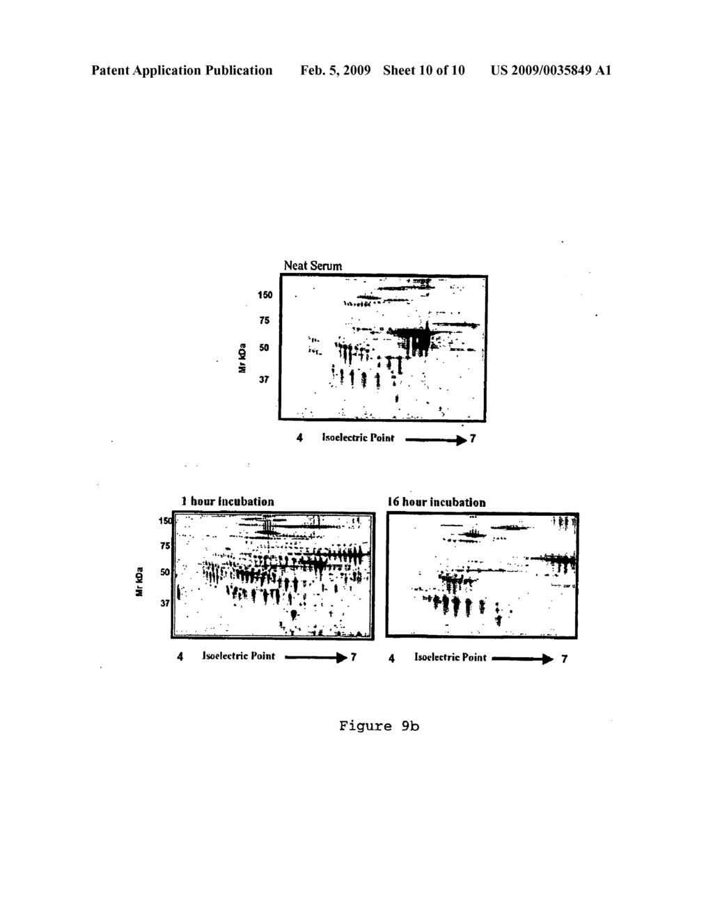 Depletion of plasma proteins - diagram, schematic, and image 11