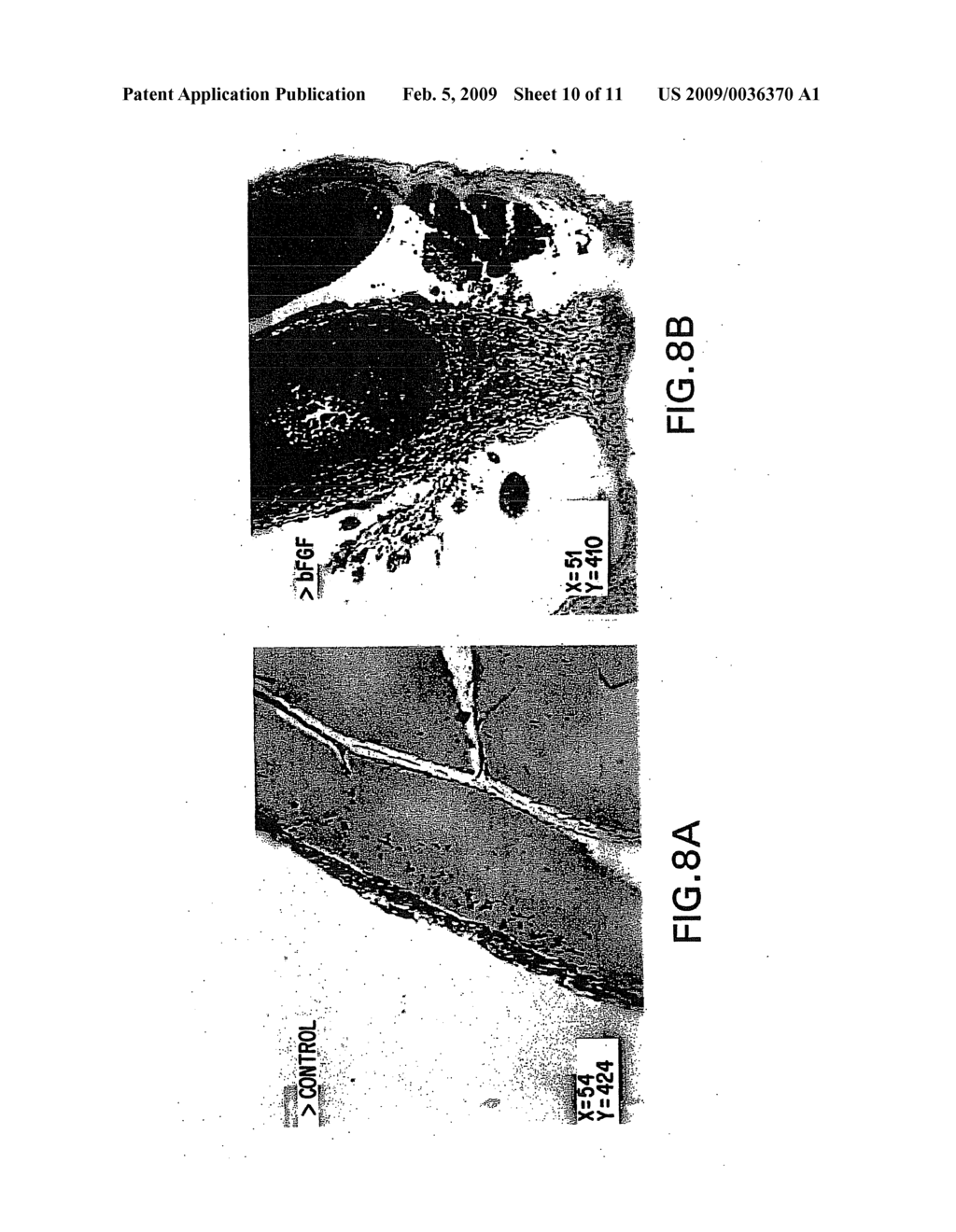 Leukocyte Adhesion Inhibitor-1 (LAI-1) - diagram, schematic, and image 11