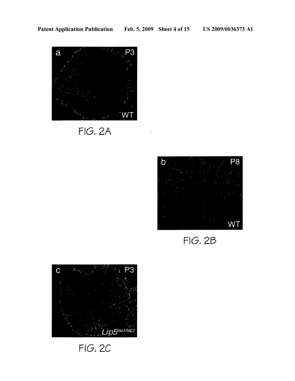 Compositions useful for and methods of modulating angiogenesis - diagram, schematic, and image 05