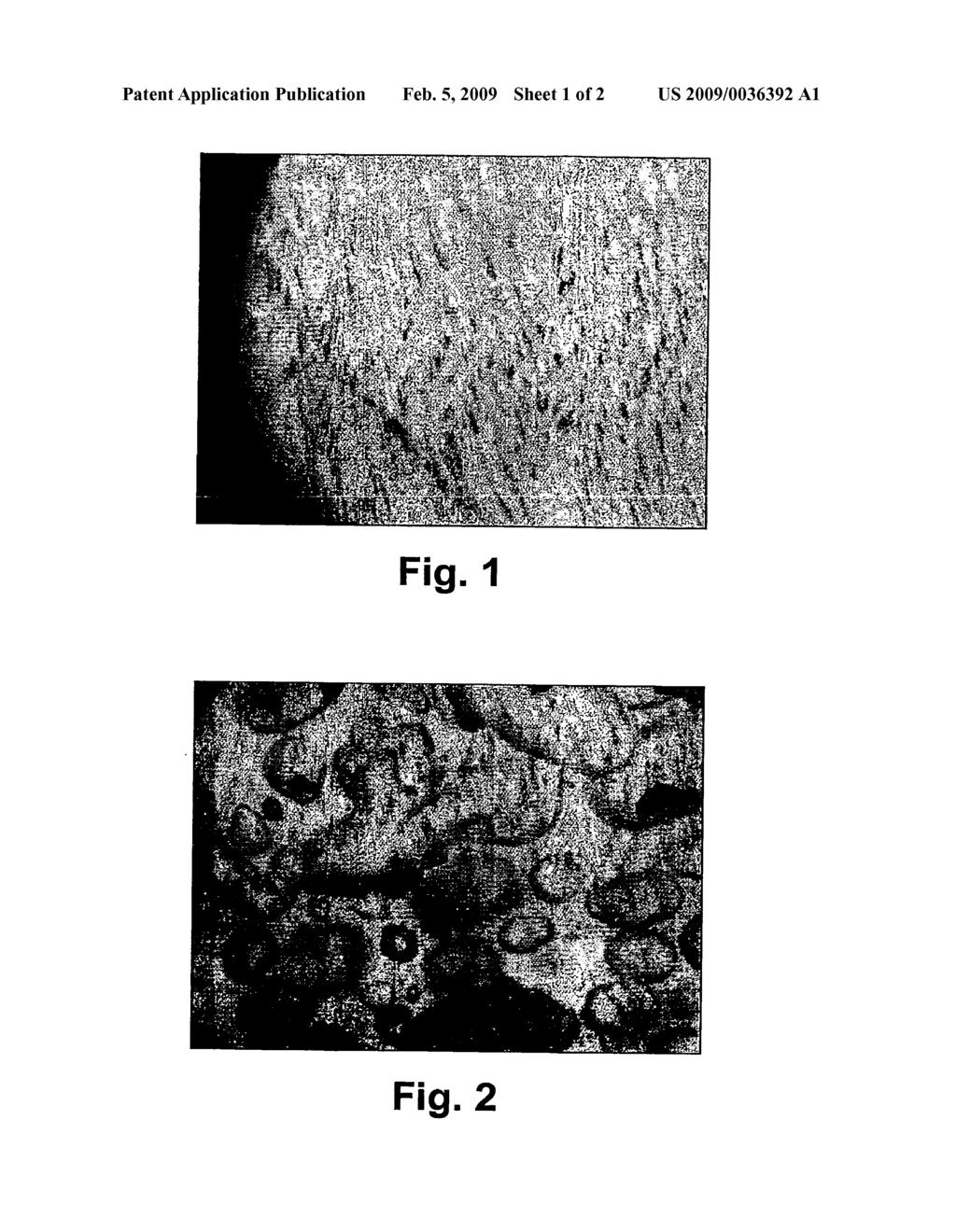 COMPOSITION COMPRISING BIODEGRADABLE HYDRATING CERAMICS FOR CONTROLLED DRUG DELIVERY - diagram, schematic, and image 02