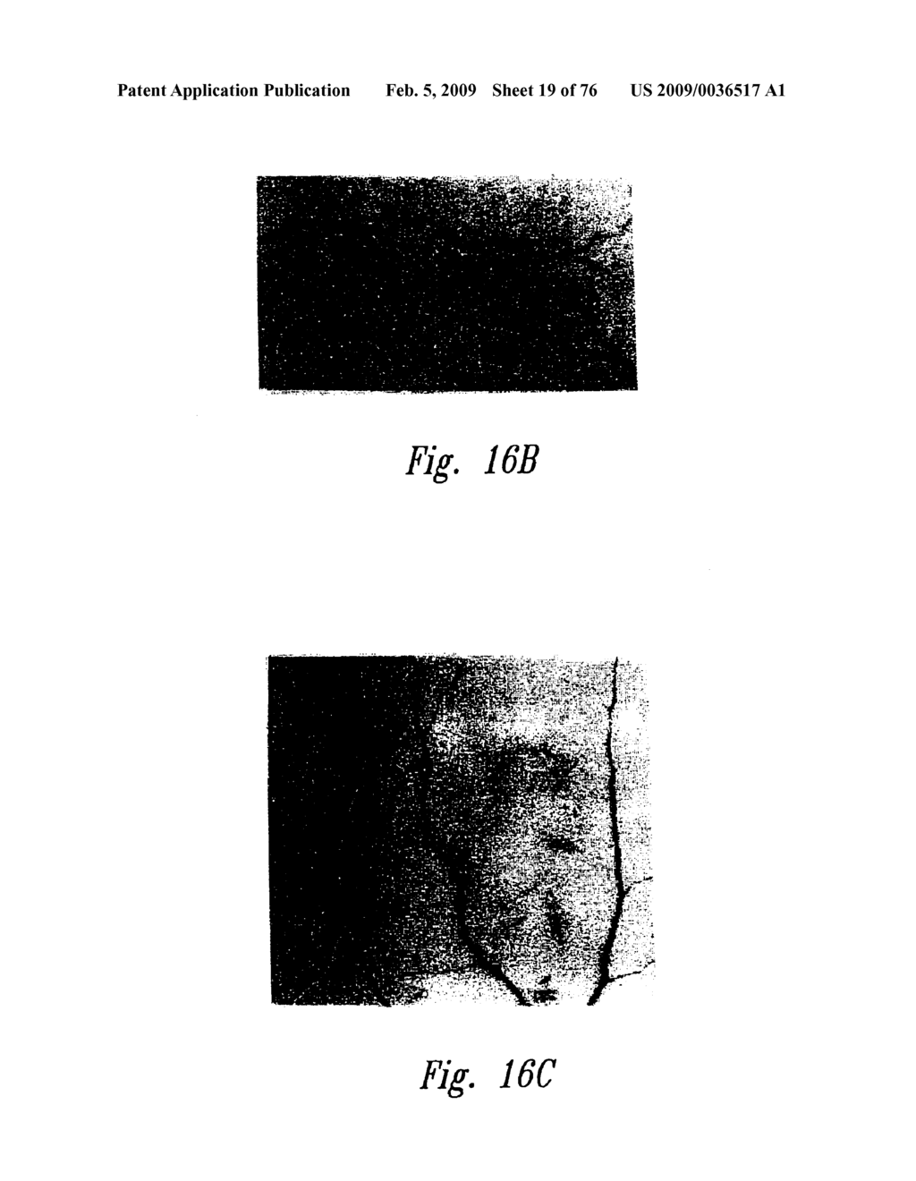 ANTI-ANGIOGENIC COMPOSITIONS AND METHODS OF USE - diagram, schematic, and image 20