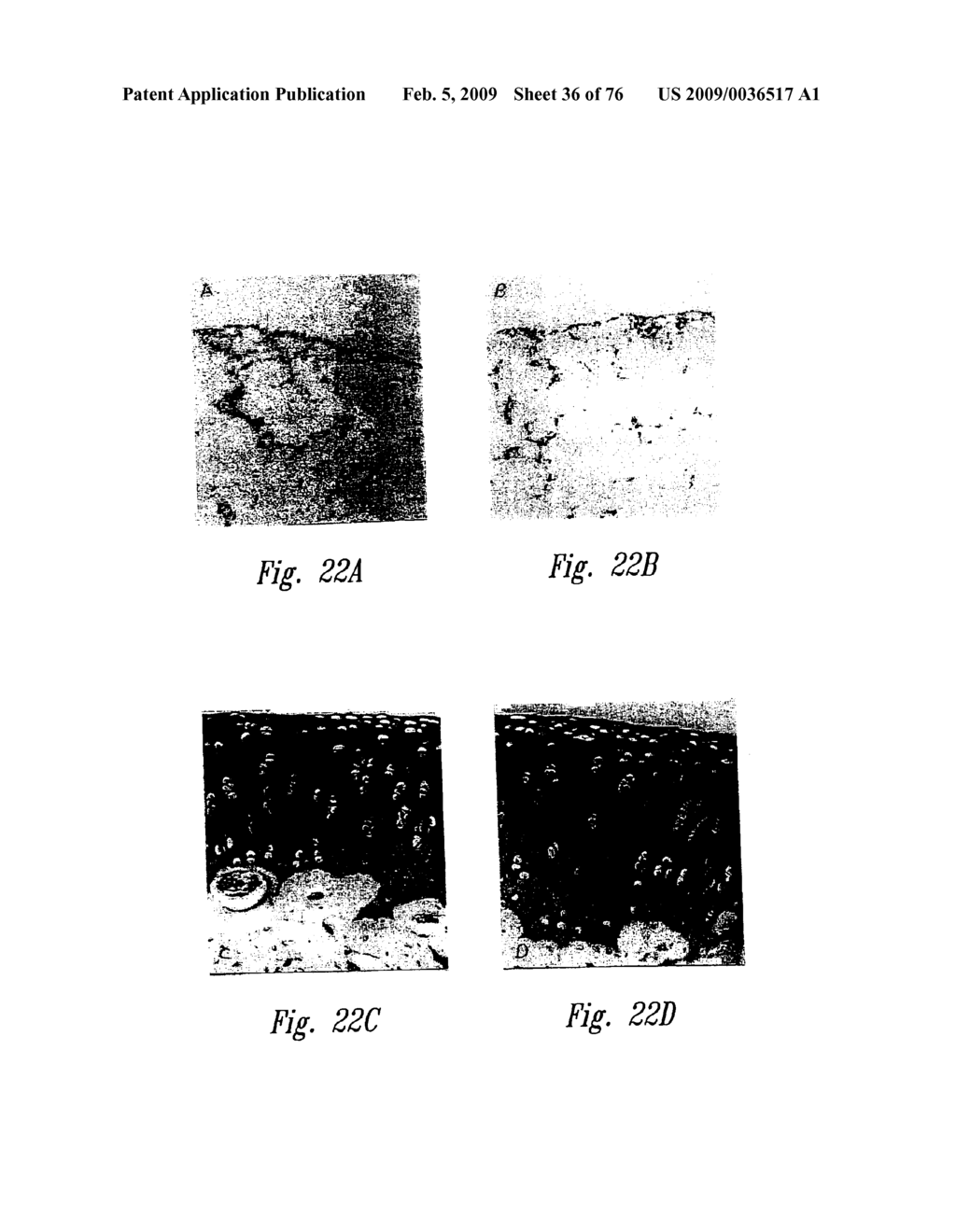 ANTI-ANGIOGENIC COMPOSITIONS AND METHODS OF USE - diagram, schematic, and image 37