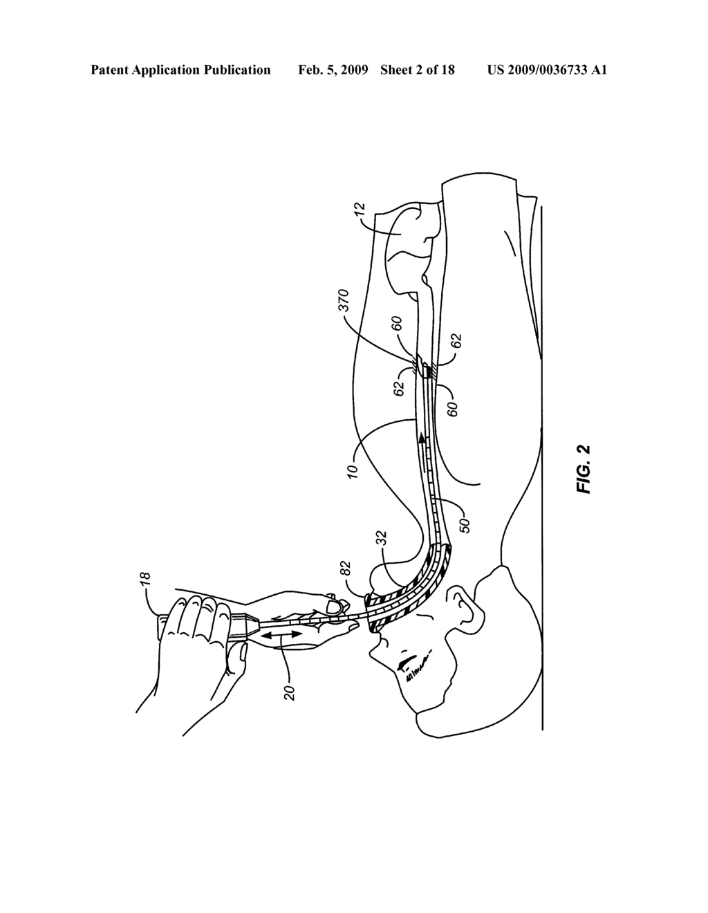 CLEANING DEVICE AND METHODS - diagram, schematic, and image 03