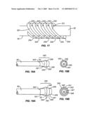 CLEANING DEVICE AND METHODS diagram and image