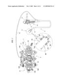 TREATMENT ENDOSCOPE diagram and image