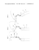 TREATMENT ENDOSCOPE diagram and image