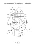 ENDOSCOPE diagram and image