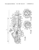 ENDOSCOPE diagram and image