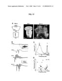 Neuronal Avalanche Assay diagram and image