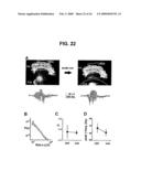 Neuronal Avalanche Assay diagram and image