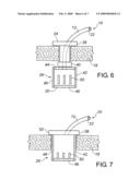 Shunt and Method Treatment of Glaucoma diagram and image