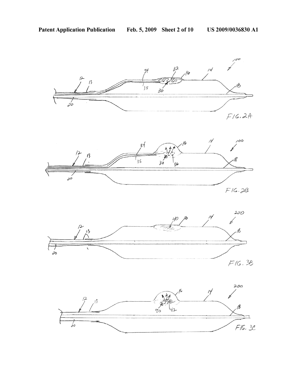 Bifurcation Treatment System and Methods - diagram, schematic, and image 03