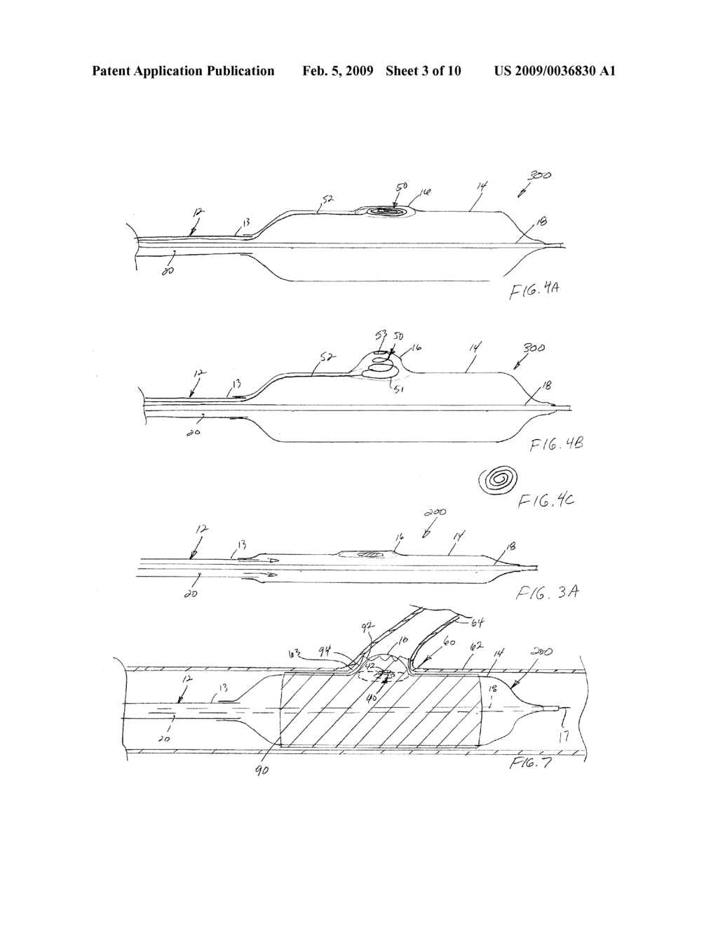 Bifurcation Treatment System and Methods - diagram, schematic, and image 04