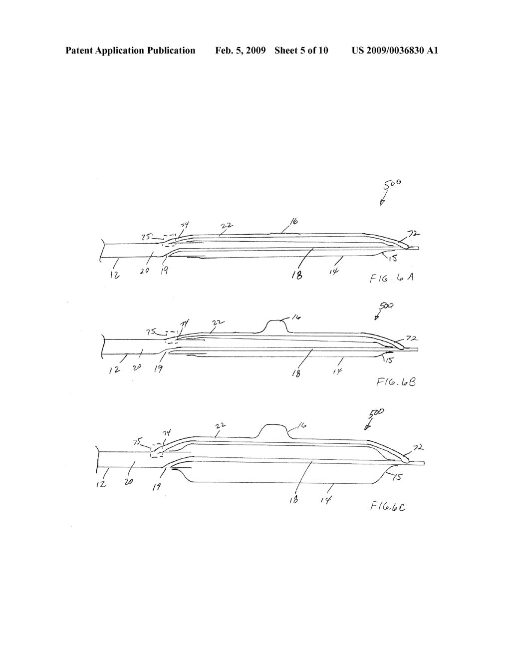 Bifurcation Treatment System and Methods - diagram, schematic, and image 06