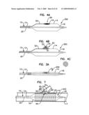 Bifurcation Treatment System and Methods diagram and image